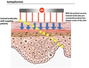 iontophoresis